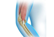 Elbow Tendon And Ligament Repair