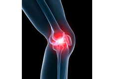 knee Pain